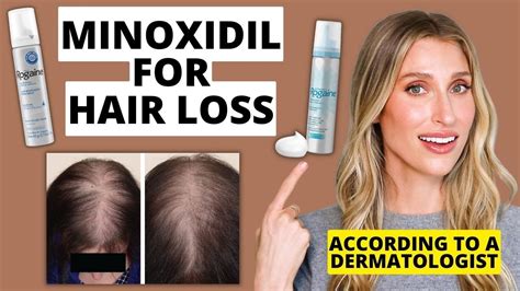 minoxidil direct|dangers of minoxidil for women.